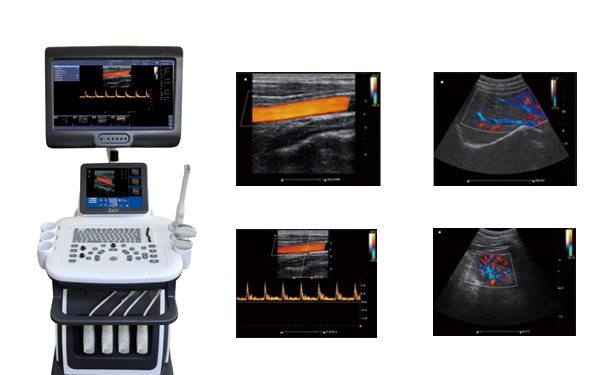 多維彩超,四維彩超機